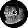 3d Röntgen Diagnose